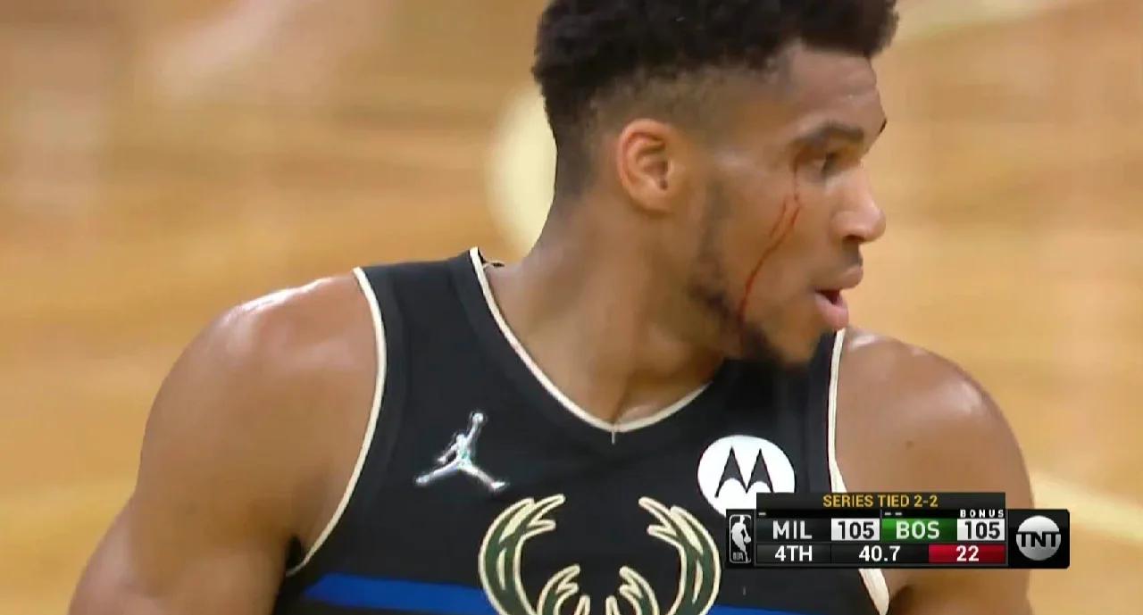 关于雄鹿队核心球员受伤成疑眼下尚未清楚的信息